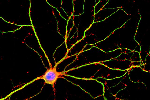 Il cervello è 10 volte più attivo di quello che si pensava