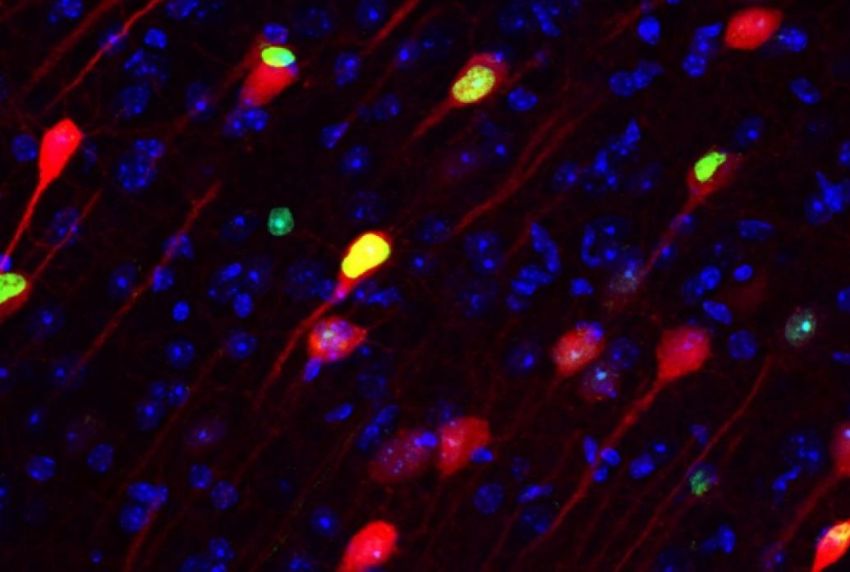 Neurons stained green and red appear over a black background MIT