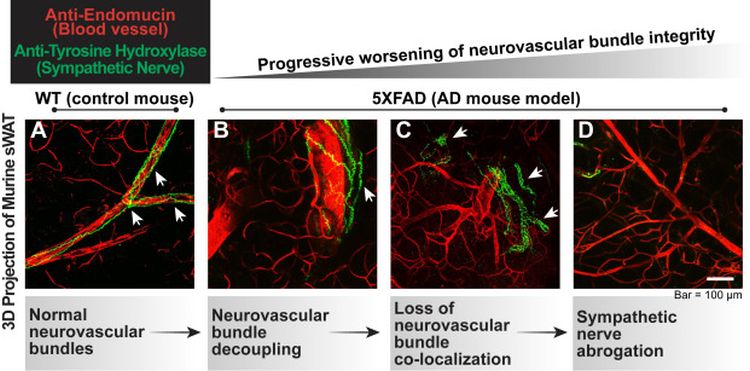 Progressive disruption of neurovascular bundles in subcutaneous adipose tissue of 5XFAD mice Kwong et al JLipidRes
