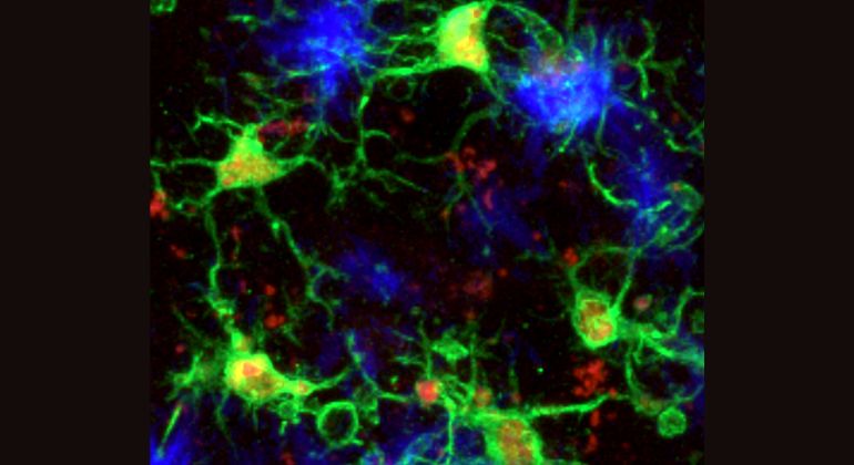 Protective microglia subtype