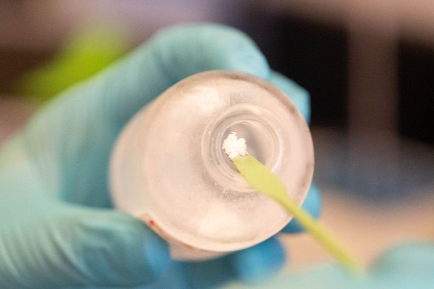 Purified human fibrinogen by Lori Chertoff RockefellerUni