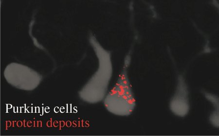 Identificato il gene che impedisce alle proteine di accumularsi