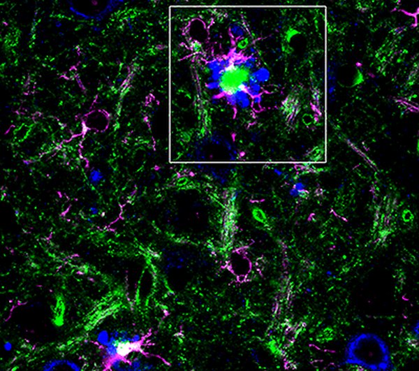 RGB Microglia BIN1