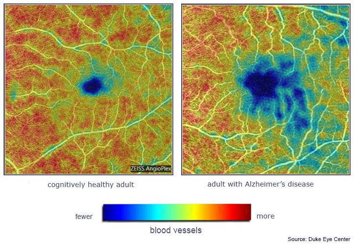 Retinal Vessels