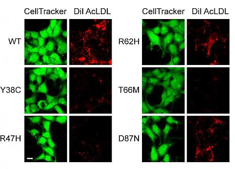 Cominciamo ora a capire la responsabilità del gene TREM2 nell'Alzheimer