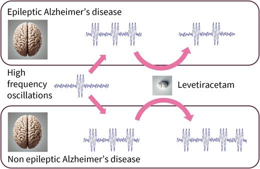 Seizure risk in alzheimer patients
