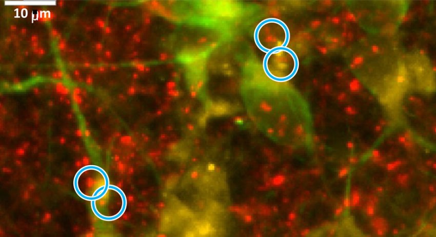 Synapses with less connections