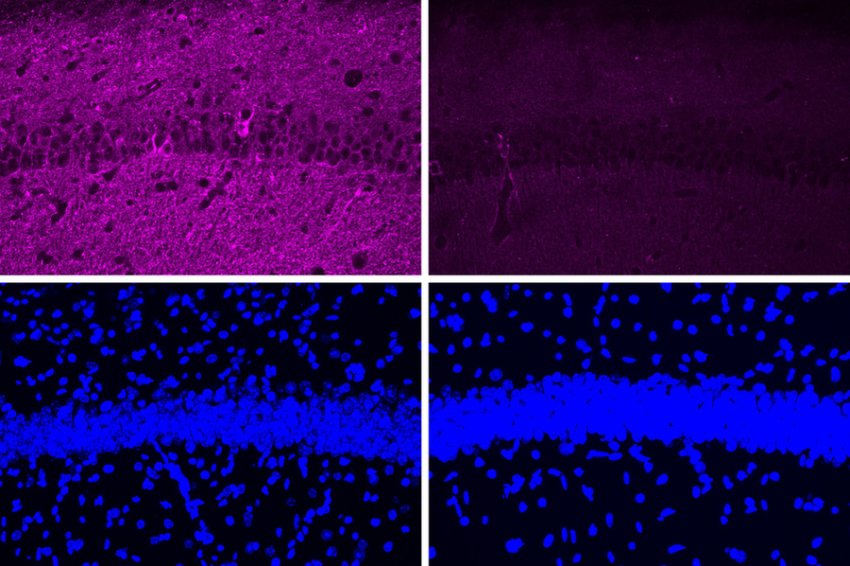 Tau in mouse brain by Ping Chieh Pao MIT