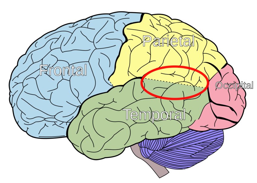 Temporo parietal junction