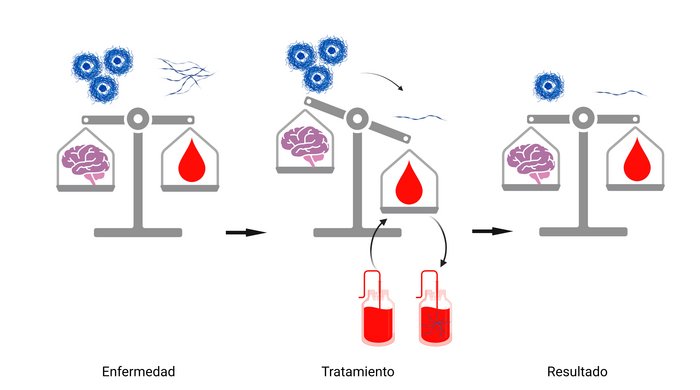 Tratamiento Alzheimer