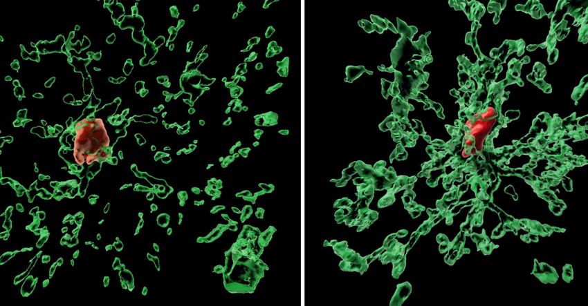 Unmutated (left) and mutated (right) microglia