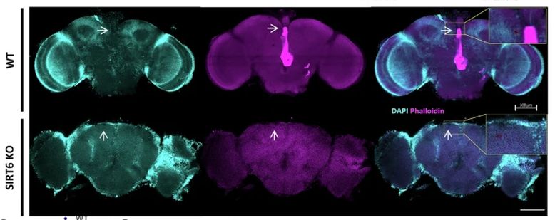 Piani interni del cervello di D. melanogaster WT (wild type, naturale) vs una senza SIRT6 (di 14 giorni) che mostrano differenze di vacuolizzazione (frecce) indice di neurodegenerazione. Fonte: Kaluski-Kopatch et al / NatComm Vacuolization differences in D melanogaster brains suggesting neurodegeneration