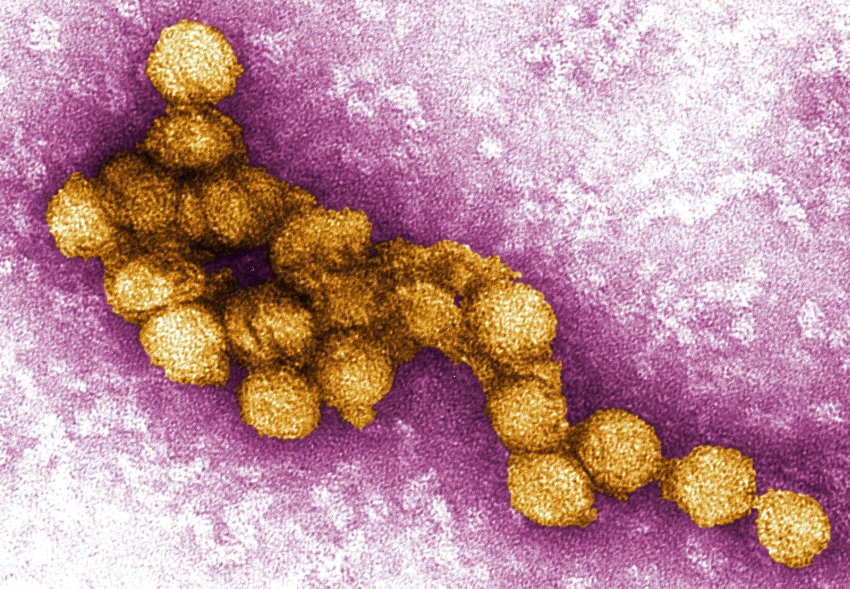 West Nile virus under electromicroscopy