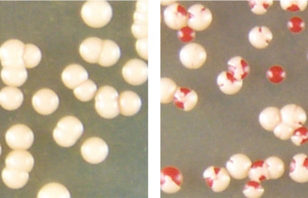 Cellule del lievito riescono ad auto-guarirsi dalla patologia presente nell'Alzheimer 