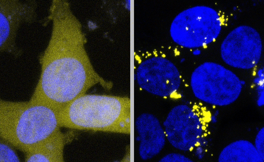 ab42 cells uninfected infected with amyloid beta prions