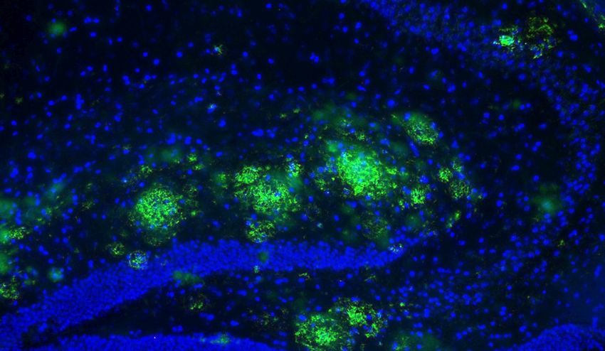 abeta plaques in hippocampus