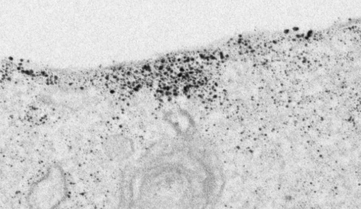 accumulated tau protein on cell membrane