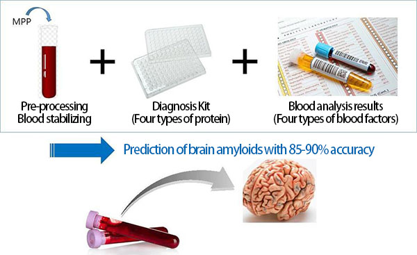 Ricercatori sudcoreani hanno sviluppato test per prevedere l'Alzheimer 