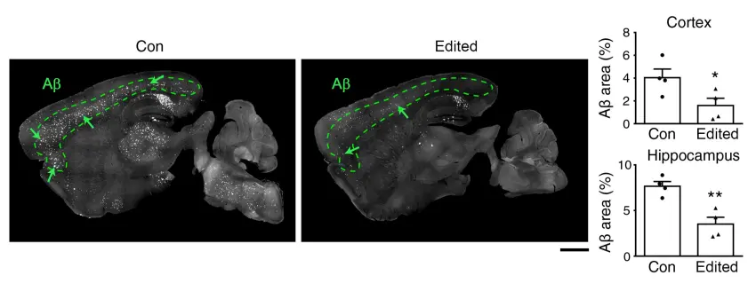 amyloid left reduced by genome editing therapy right