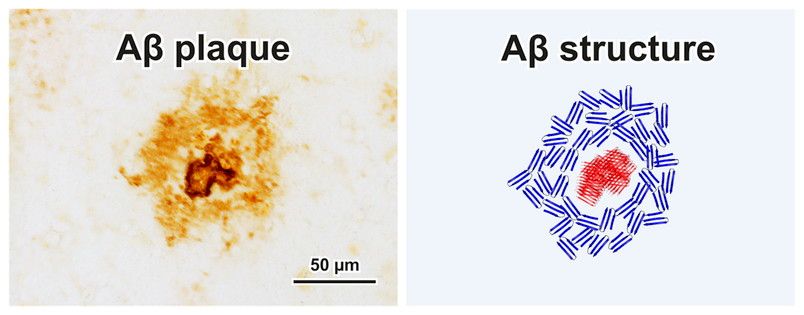 amyloid conclusion final flat ccp eng