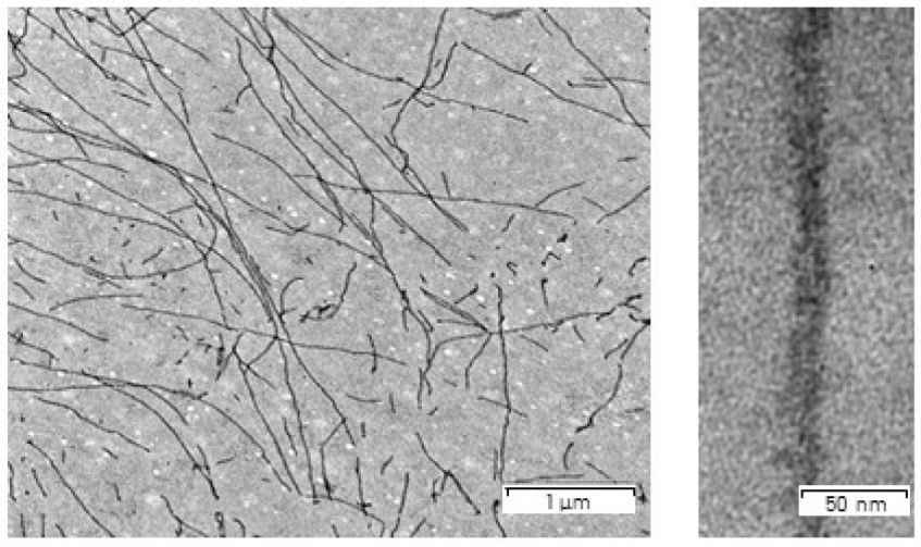 amyloid fibrils