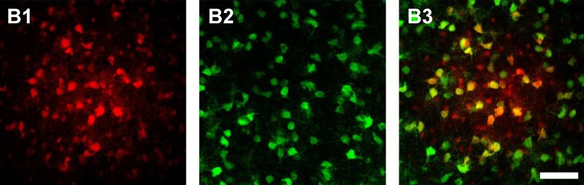 astrocytes and oligodendrocytes