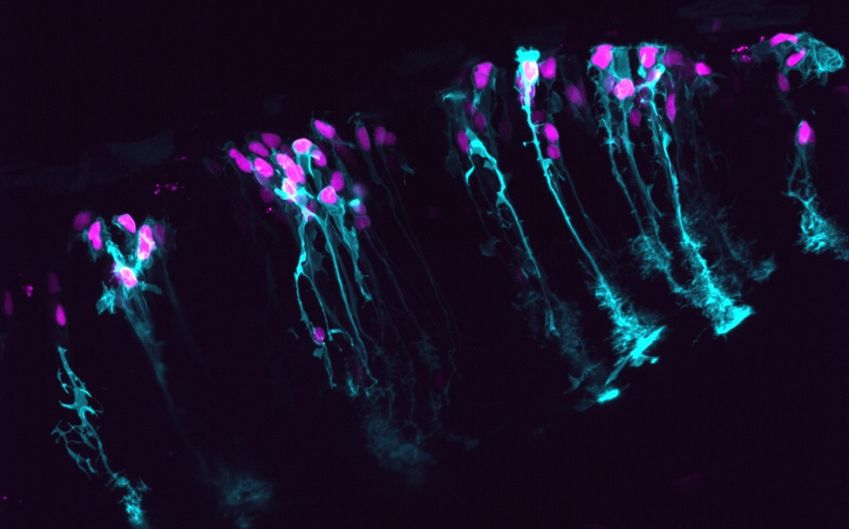astroglia from FloridaAtlanticUni