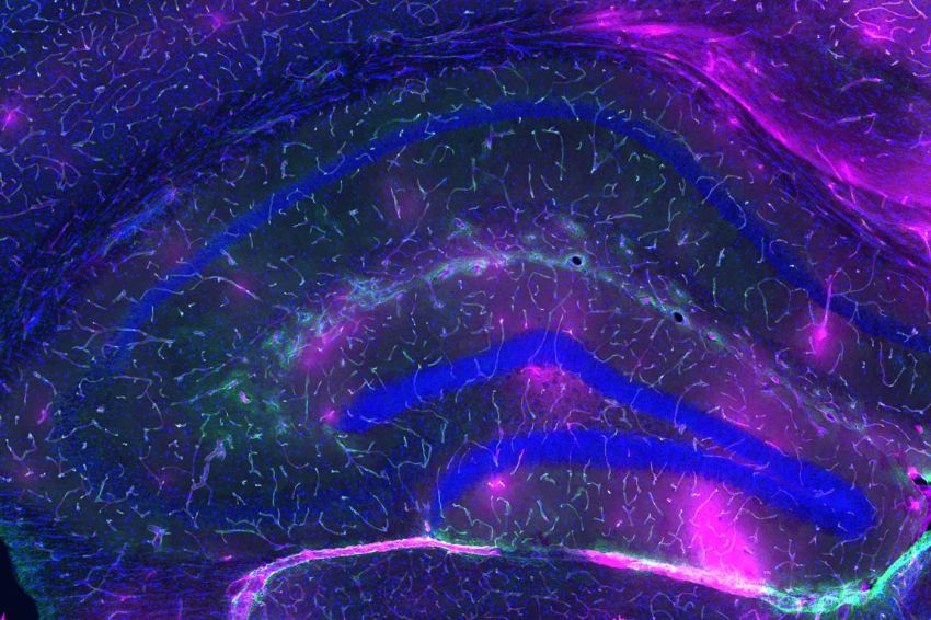 blood brain barrier leaking dye in aged mouse by Villeda Lab at UCSF