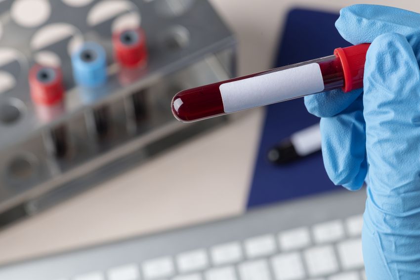 blood test biomarkers 