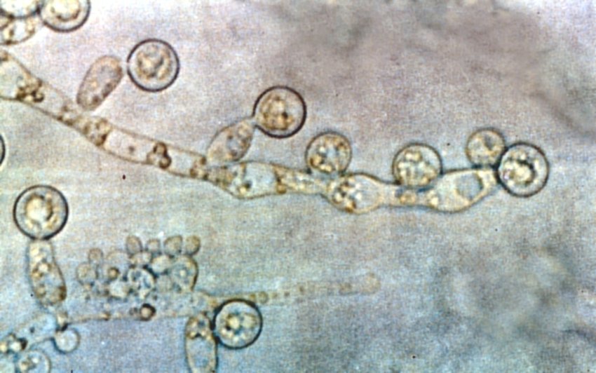 candida albicans