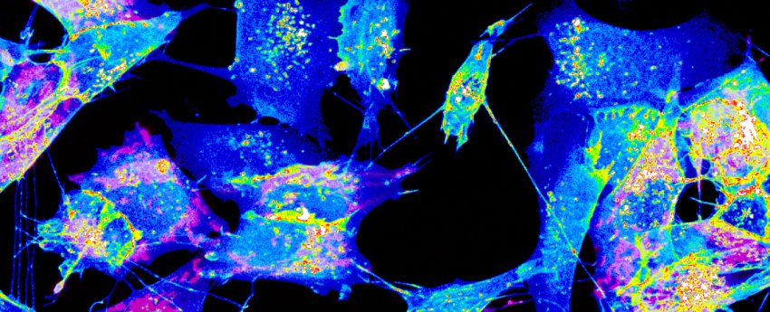 cells connected by nanotubes