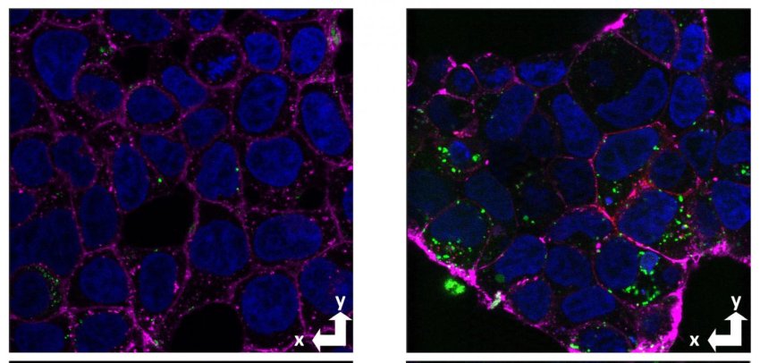 cells with and without the cellular prion protein