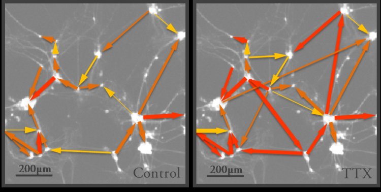 Cosa succede quando i neuroni smettono di funzionare?