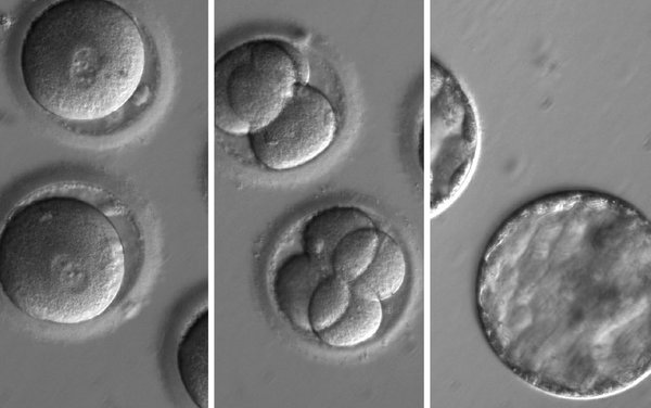 Il laboratorio dove si modifica il DNA umano per evitare malattie gravi