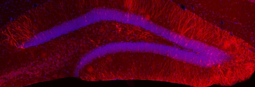 engram cells red in dentate gyrus