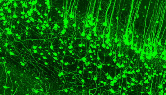 Nuova tecnica di scansione per una visuale più chiara del sistema nervoso, e dei suoi problemi