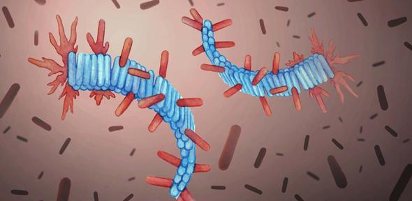 Lento, lento, veloce, veloce, lento: ecco il ritmo di accumulo delle proteine nel cervello di Alzheimer