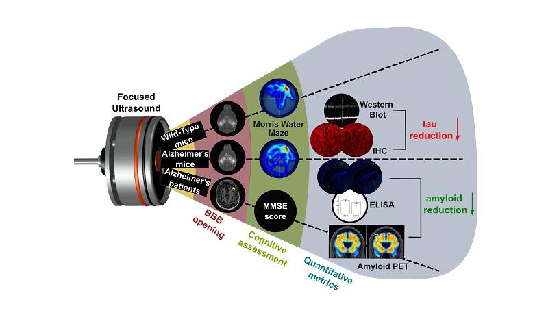 focused ultrasound theranostics