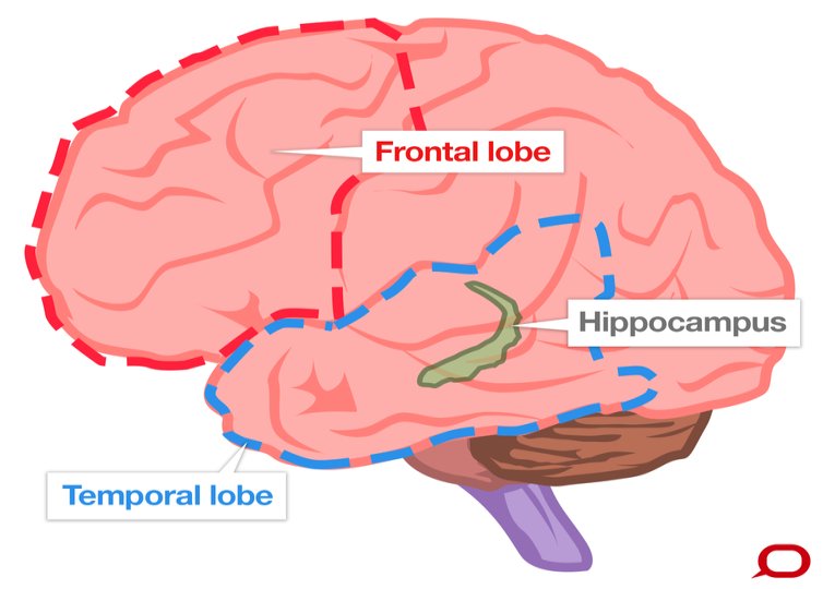 frontal temporal lobes and hippocampus