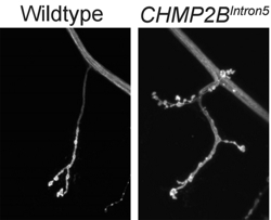 Individuate nuove fasi nella progressione della demenza