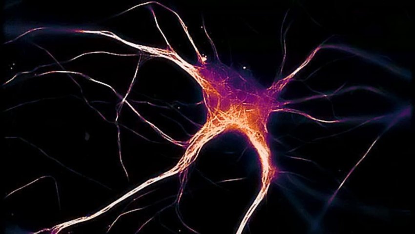 functioning neuron expressing diseased tau