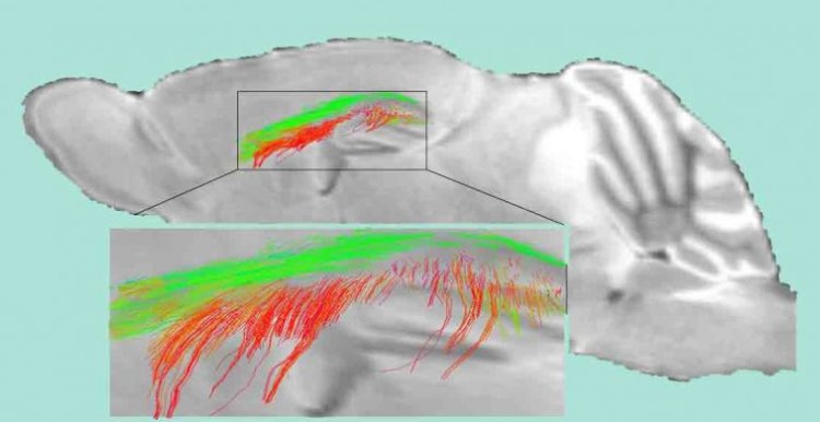 Metà delle demenze, incluso l'Alzheimer, inizia con danni alle 'cellule portinaie'