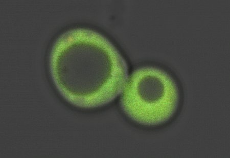 L'eme, nutriente essenziale ma velenoso, può indurre l'AD