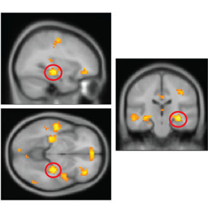 Come ricorda gli avvenimenti del passato il cervello? Rivivendoli