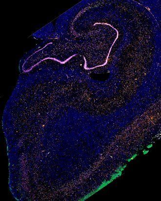 human brain tissue samples for Alzheimers research