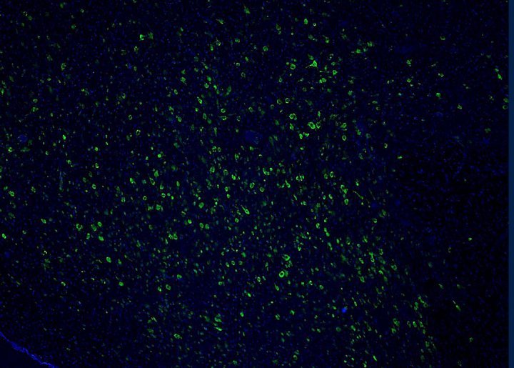 human histaminergic neurons