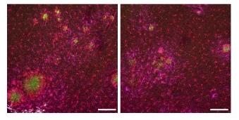 Studio (sui topi) indica che l'Alzheimer potrebbe essere trattato con la terapia genica