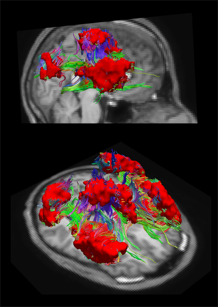 Un nuovo atlante del cervello offre mezzi alternativi per studiare i disturbi cerebrali