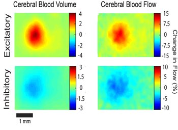 increased activity in inhibitory neural circuits