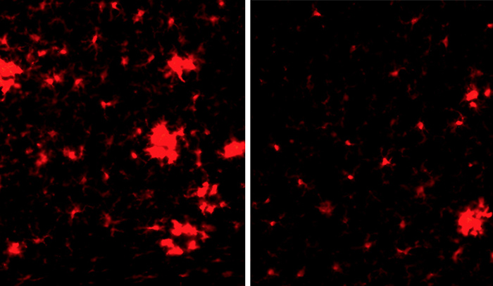 I cambiamenti nel sistema vascolare possono scatenare l'Alzheimer